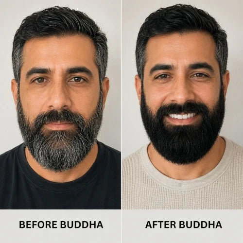 🧔‍♂️ Anti Grey Beard Serum Oil ⚡ | Restore Natural Beard Color & Boost Healthy Growth 🌿 | Buy 1  Get 1 Free✨